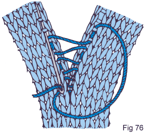 Fig 76